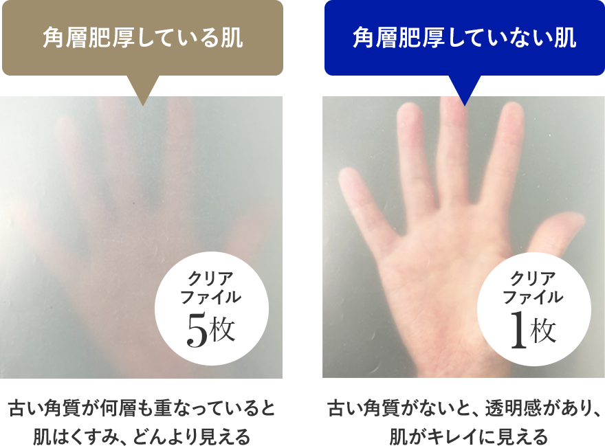 角層肥厚している肌  角層肥厚していない肌