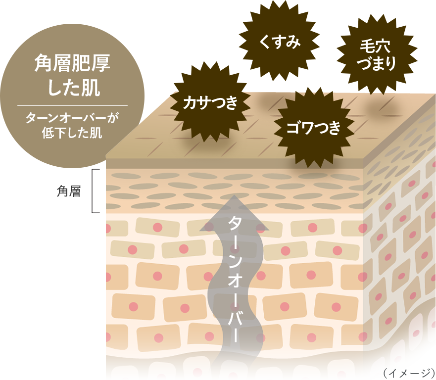 角層肥厚した肌 イメージ
