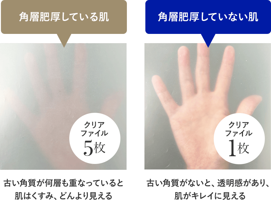 角層肥厚している肌  角層肥厚していない肌