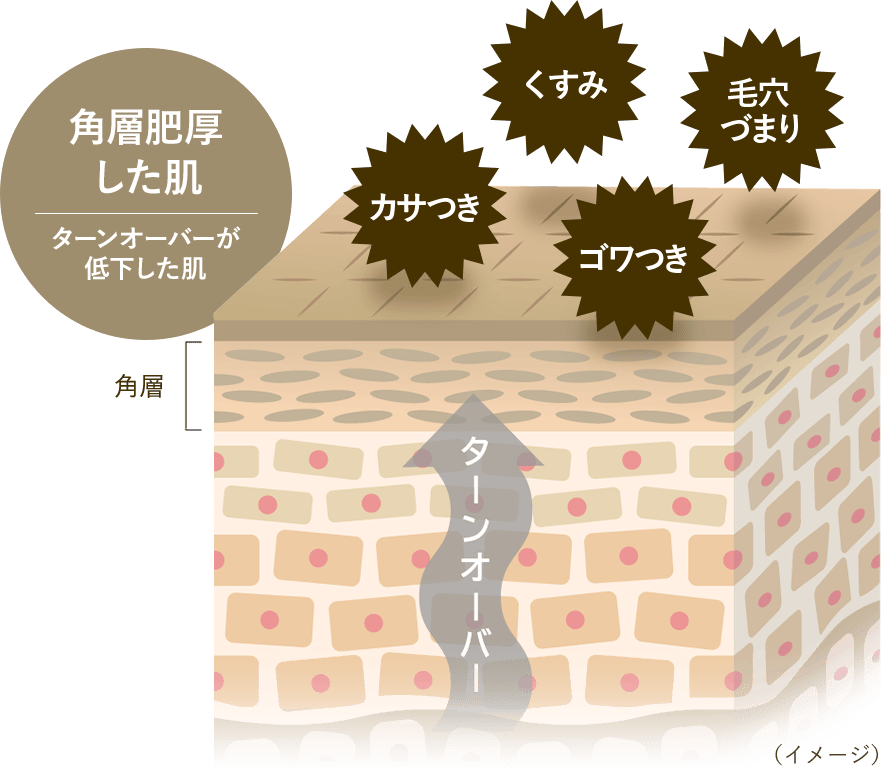 角層肥厚した肌 イメージ