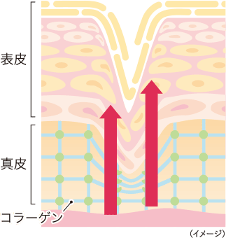 表皮 表皮細胞の増殖を促進し、シワを改善
