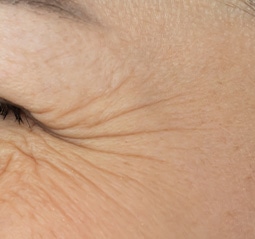 シワの目立つ肌