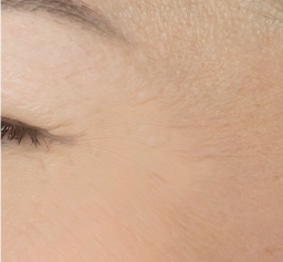 シワ目立たない肌が