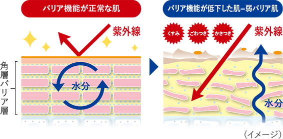 バリア機能が正常な肌　バリア機能が低下した肌ー弱バリア肌
