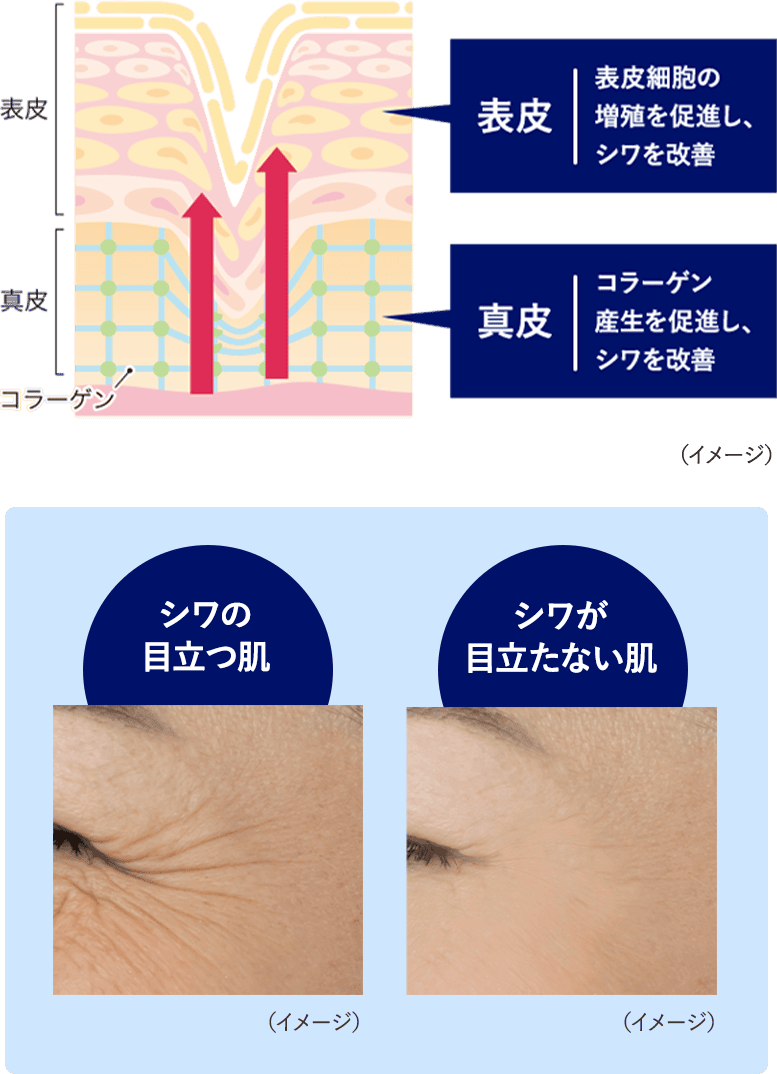 表皮　真皮　シワの目立つ肌　シワが目立たない肌