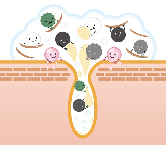 泡が不要な皮脂や毛穴汚れを包み込むイメージ画像