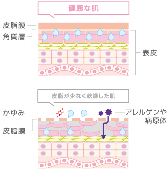 健康な肌と皮脂が少なく乾燥した肌