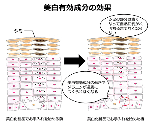 シミ 美白ケア 肌悩みの原因を解説 美肌カレッジ 美容情報 Beauty Topics Maison Kose メゾンコーセー