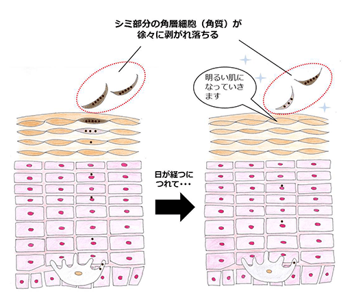 シミ 美白ケア 肌悩みの原因を解説 美肌カレッジ 美容情報 Beauty Topics Maison Kose メゾンコーセー