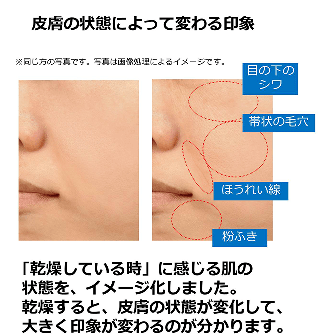 たるみ たるみ毛穴 肌悩みの原因を解説 美肌カレッジ 美容情報 Beauty Topics Maison Kose メゾンコーセー