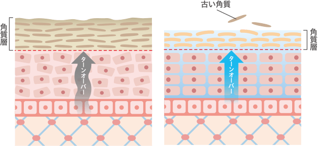 くすんだ肌のイメージ