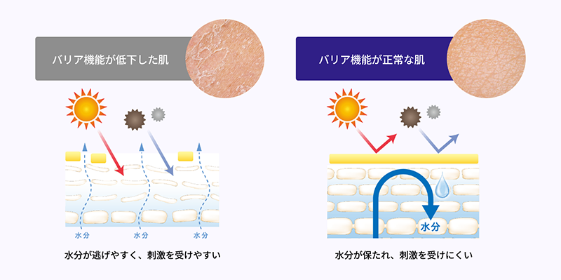 過酷環境に左右され、肌がゆらいだり乾燥するのは、バリア機能の低下が原因の可能性・・・！