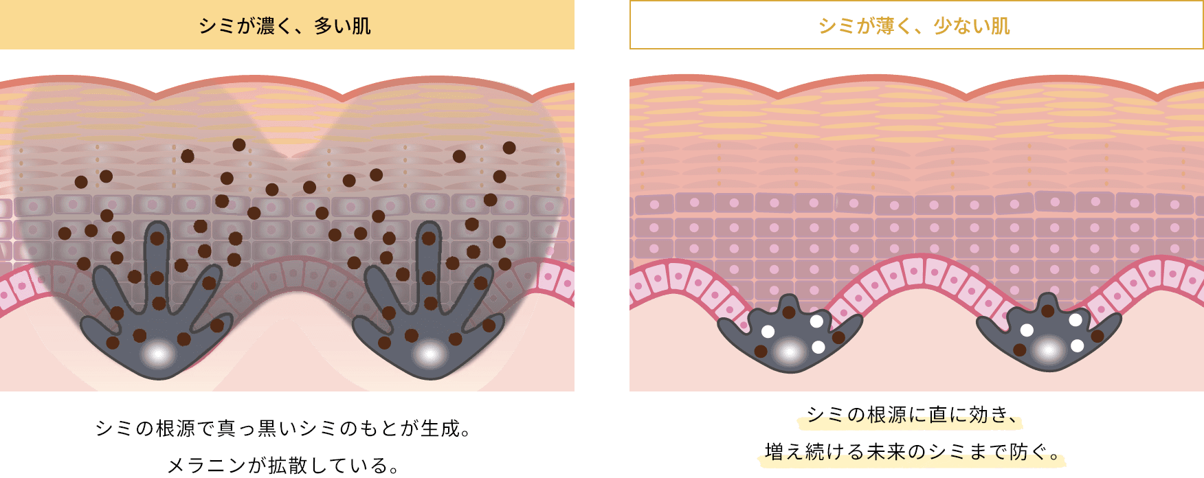 シミが濃く、多い肌シミの根源で真っ黒いシミのもとが生成。メラニンが拡散している。 シミが薄く、少ない肌シミの根源に直に効き、増え続ける未来のシミまで防ぐ。