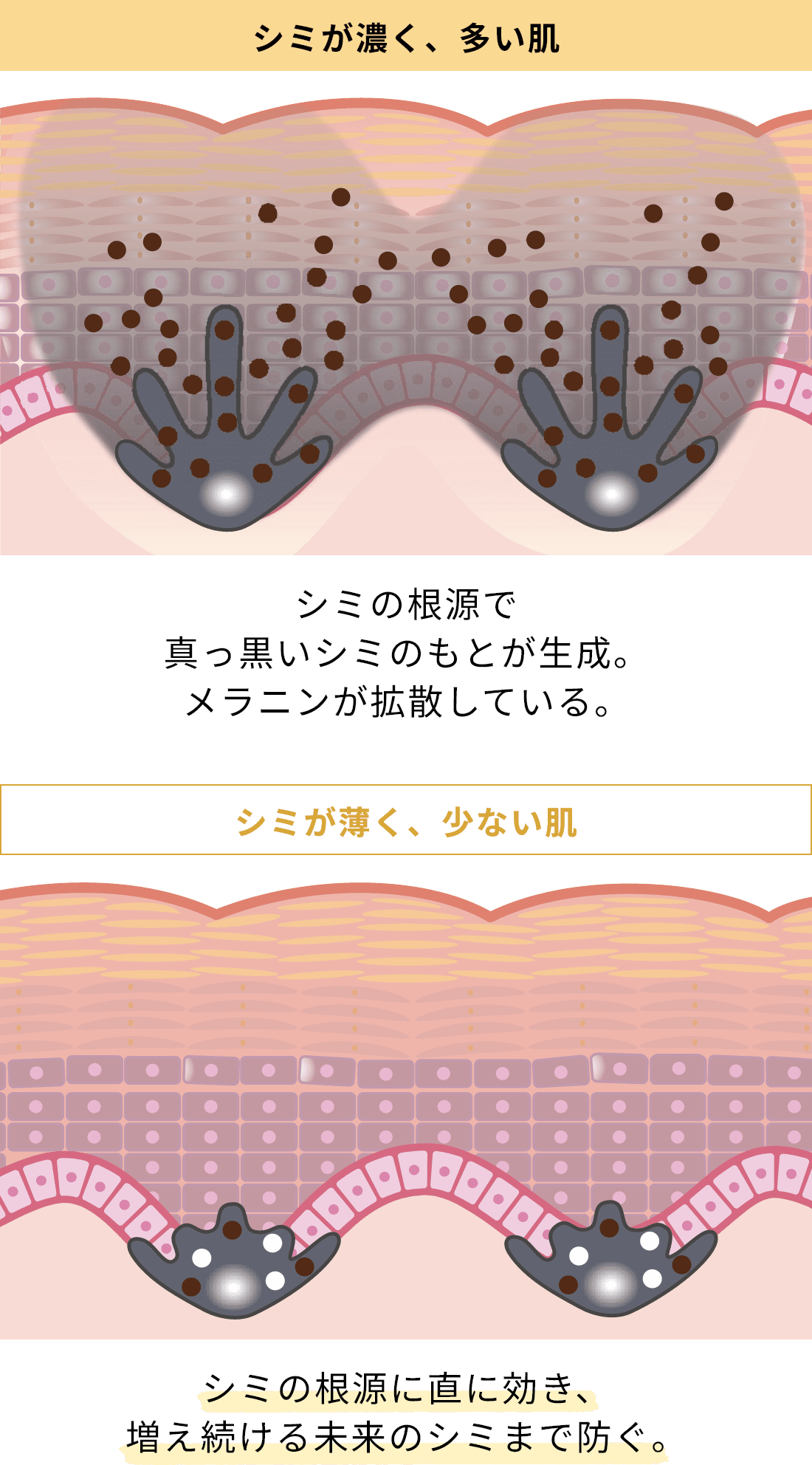 シミが濃く、多い肌シミの根源で真っ黒いシミのもとが生成。メラニンが拡散している。 シミが薄く、少ない肌シミの根源に直に効き、増え続ける未来のシミまで防ぐ。