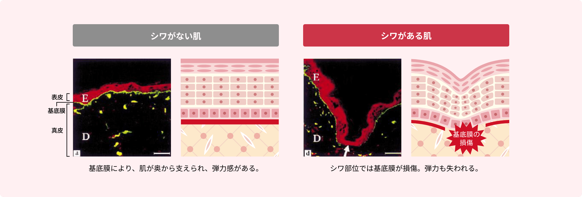 シワと基底膜コラーゲンの関係性 イメージ