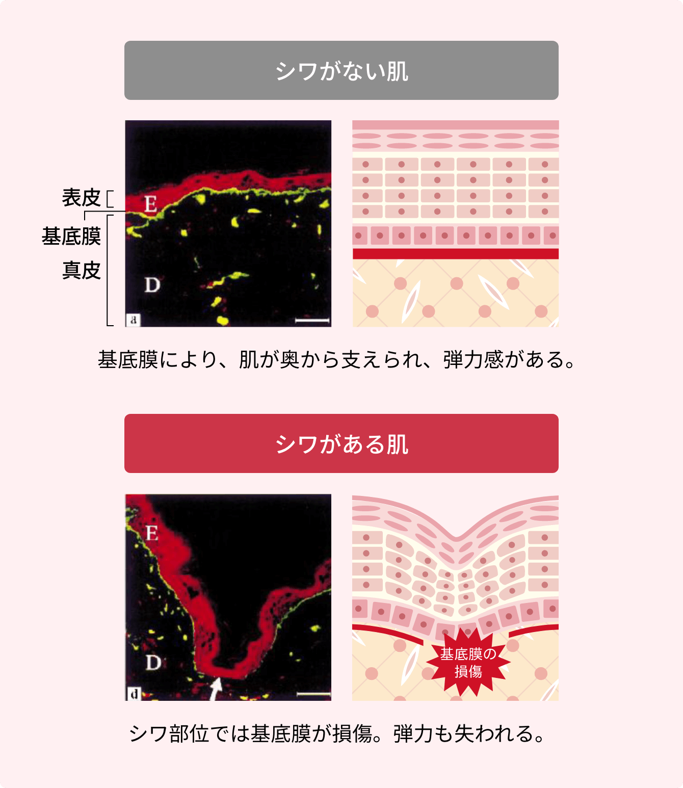 シワと基底膜コラーゲンの関係性 イメージ