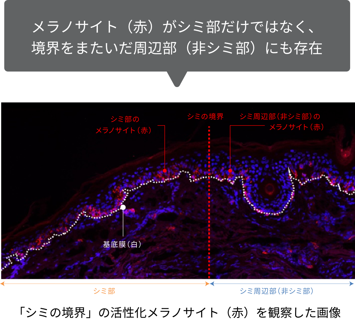 メラノサイト（赤）がシミ部だけではなく、境界をまたいだ周辺部（非シミ部）にも存在