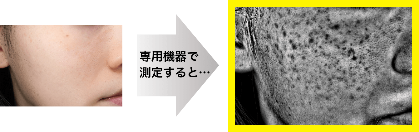 専用機器で測定すると&hellip;