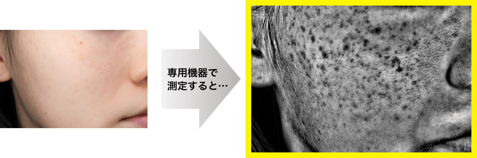 専用機器で測定すると&hellip;