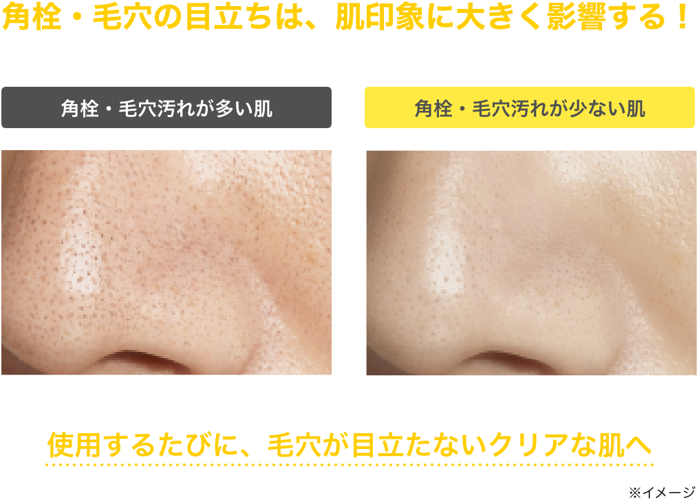 CLEAR PEEL SERUM｜ONE BY KOSE｜ Maison KOSÉ(メゾンコーセー)