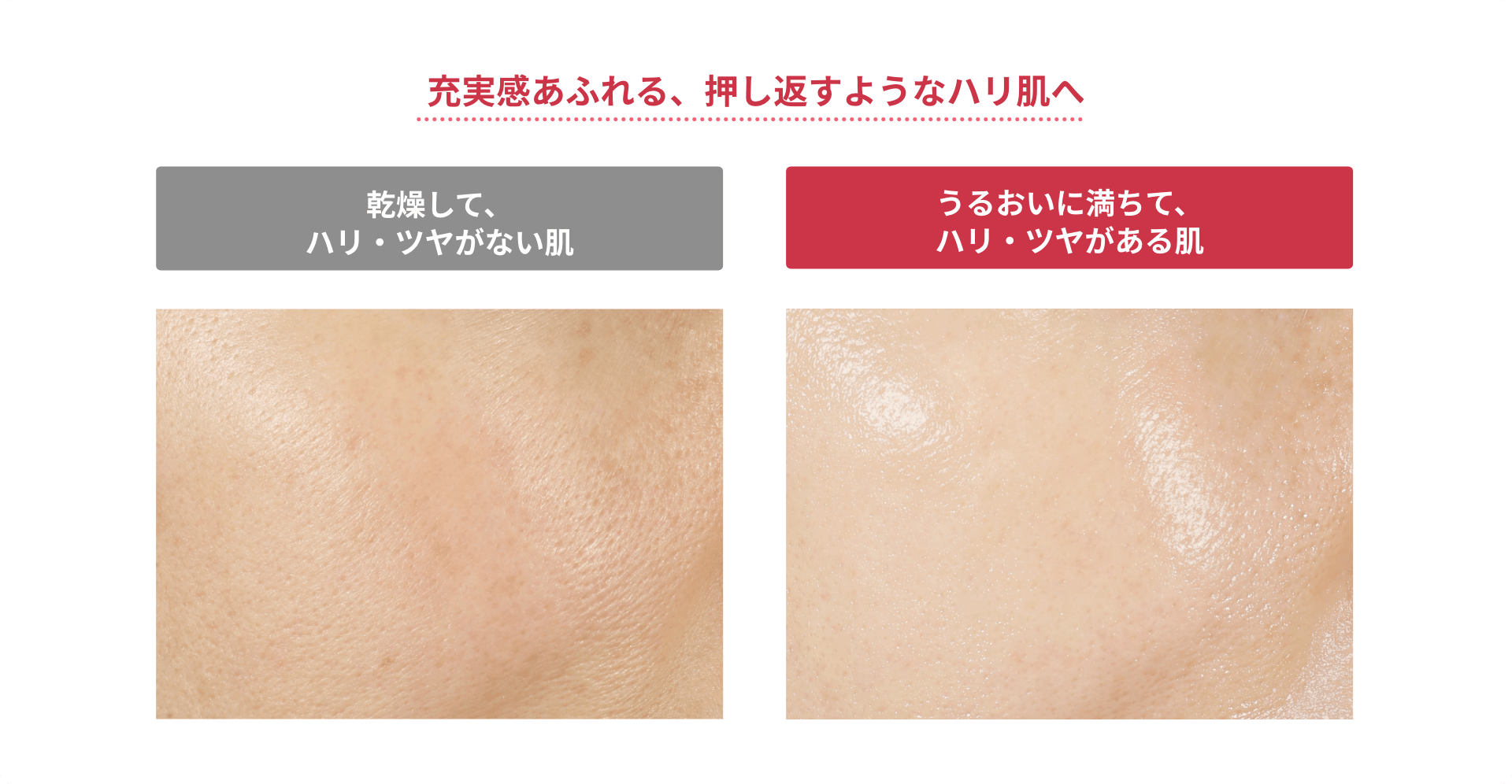 充実感あふれる、押し返すようなハリ肌へ