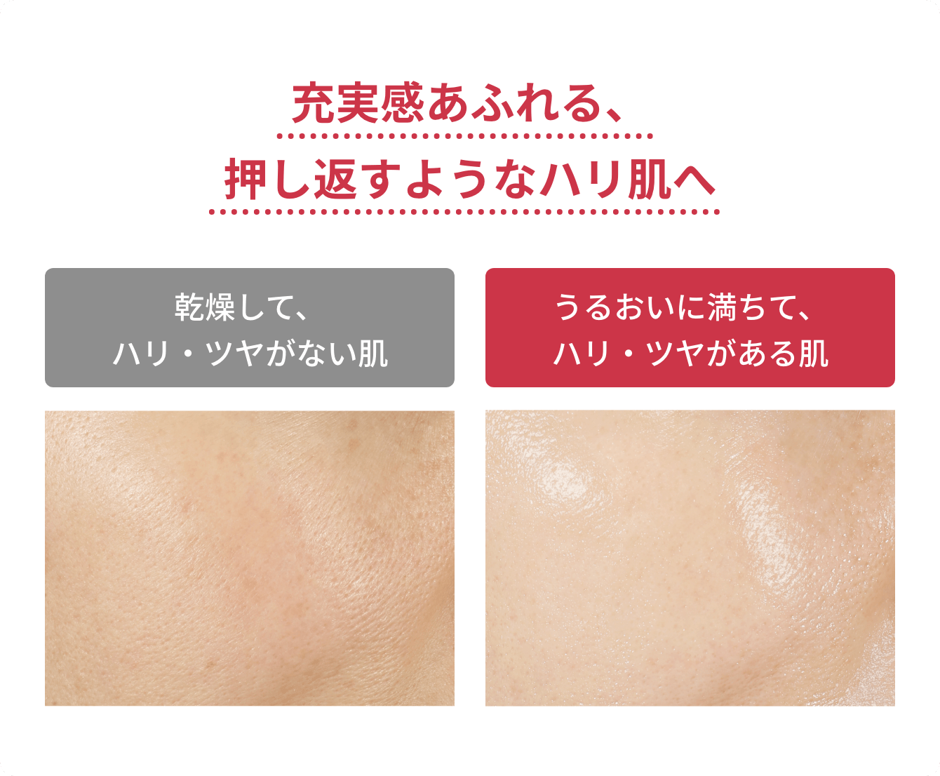 充実感あふれる、押し返すようなハリ肌へ