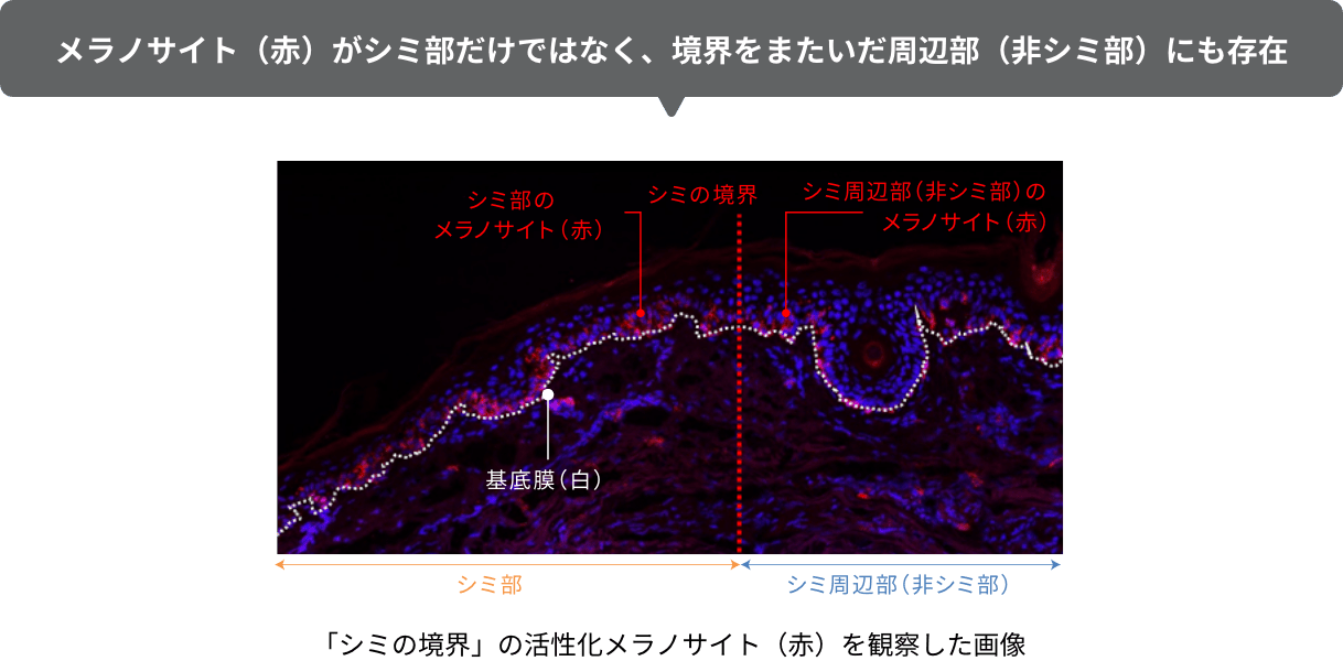 メラノサイト（赤）がシミ部だけではなく、境界をまたいだ周辺部（非シミ部）にも存在