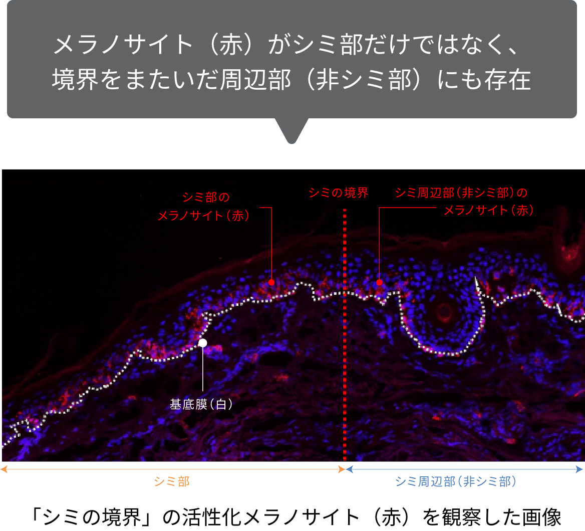 メラノサイト（赤）がシミ部だけではなく、境界をまたいだ周辺部（非シミ部）にも存在