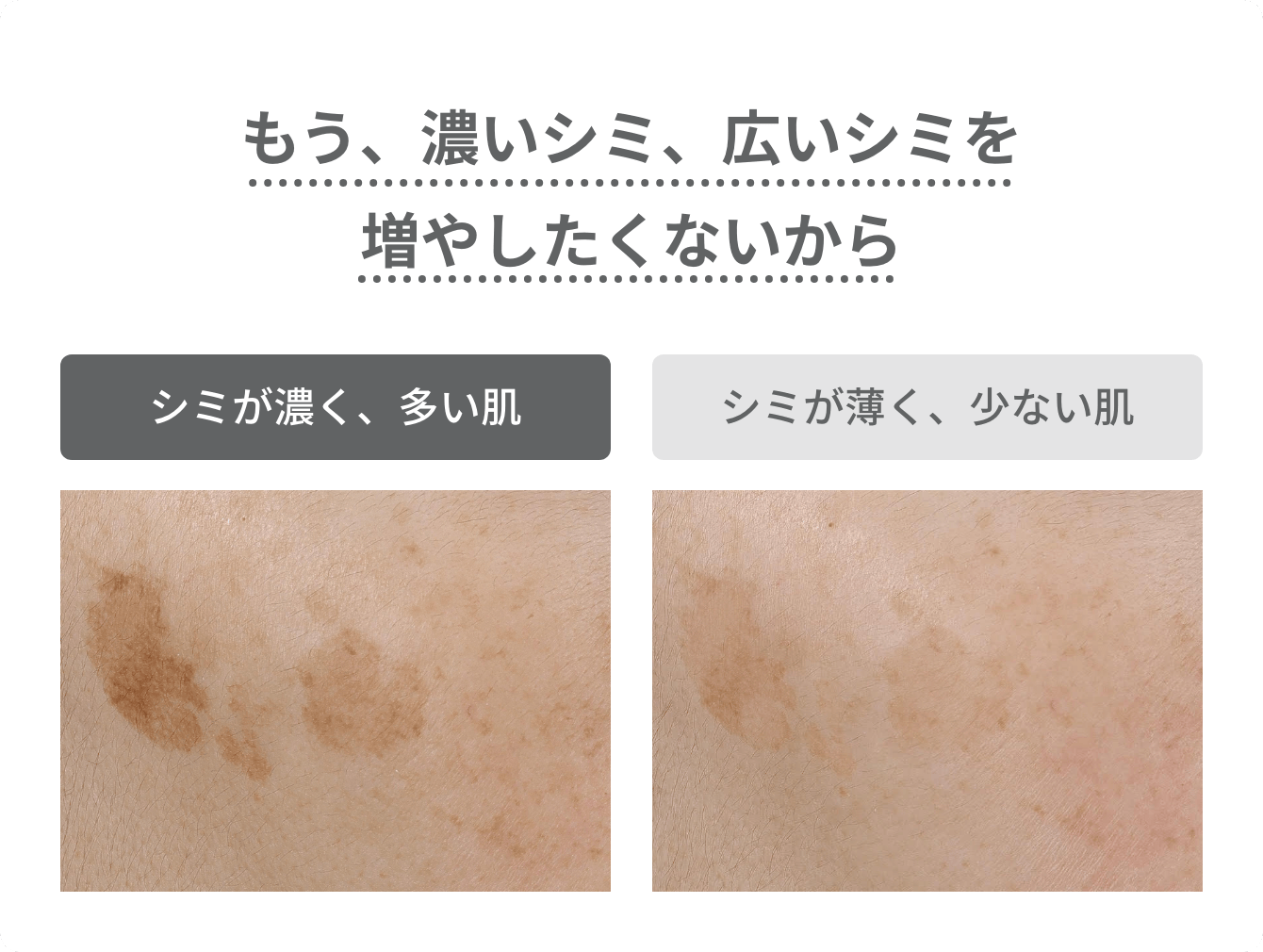 もう、濃いシミ、広いシミを増やしたくないから