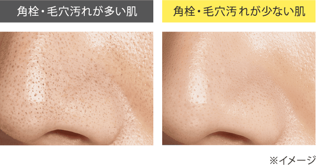 ONE BY KOSÉ】 成果が見える毛穴ケア| 美容情報 - 株式会社