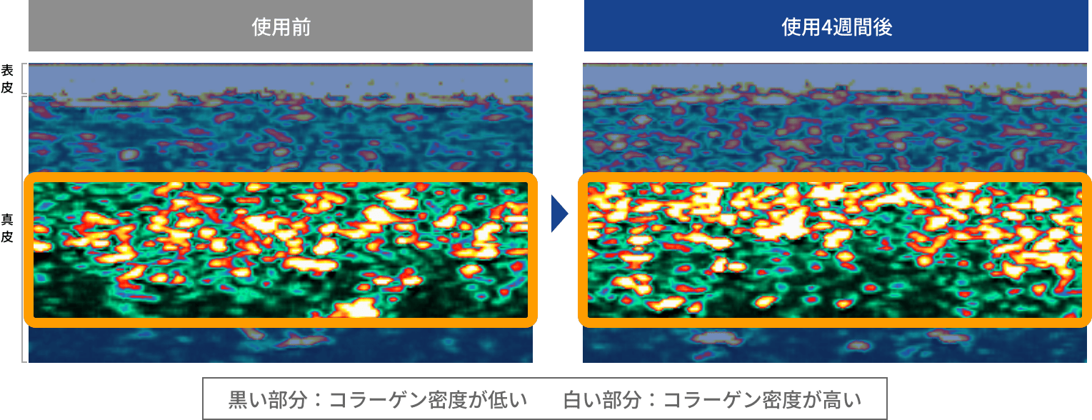 肌内部のコラーゲン密度が増加