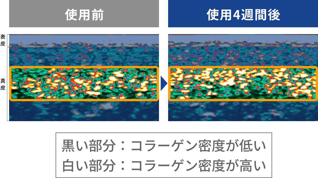 肌内部のコラーゲン密度が増加