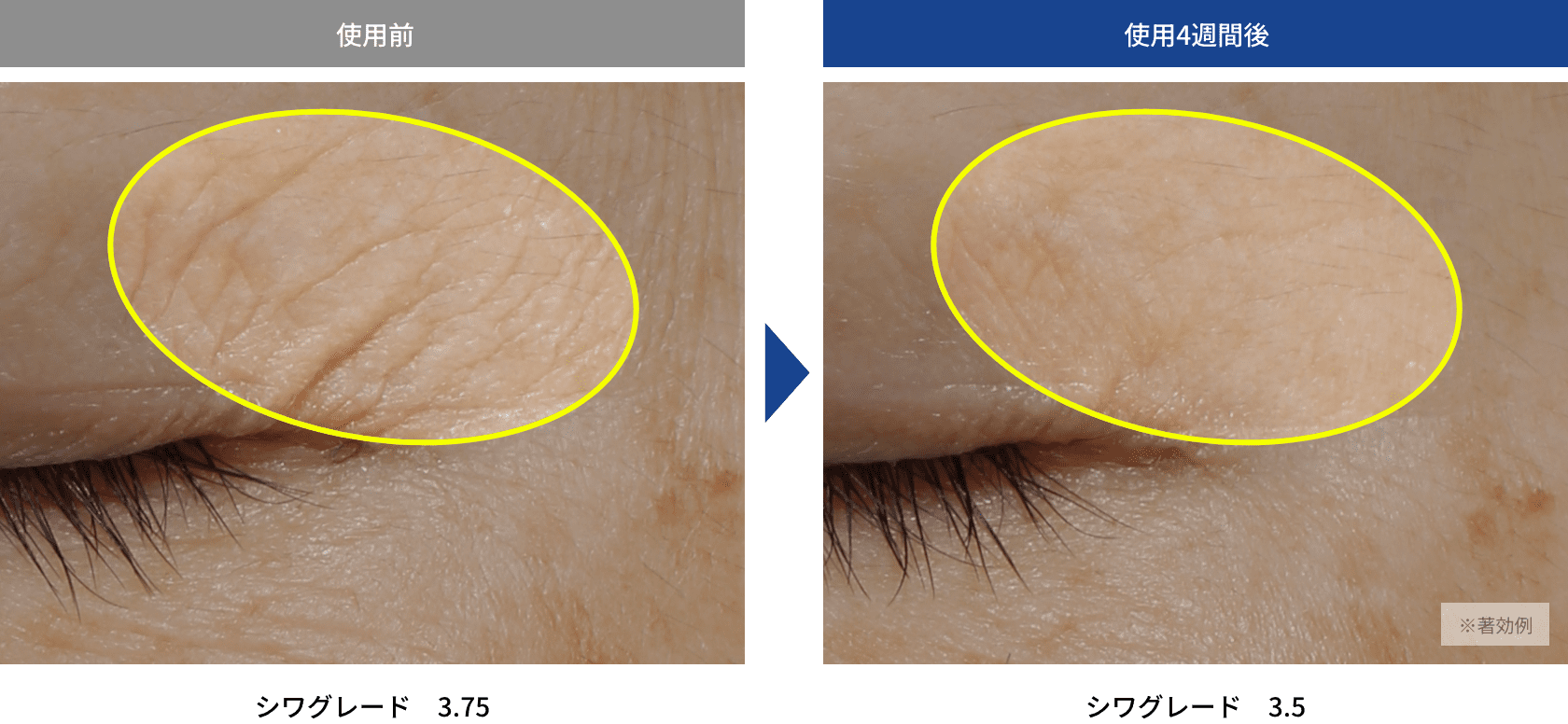 目もと、首もと