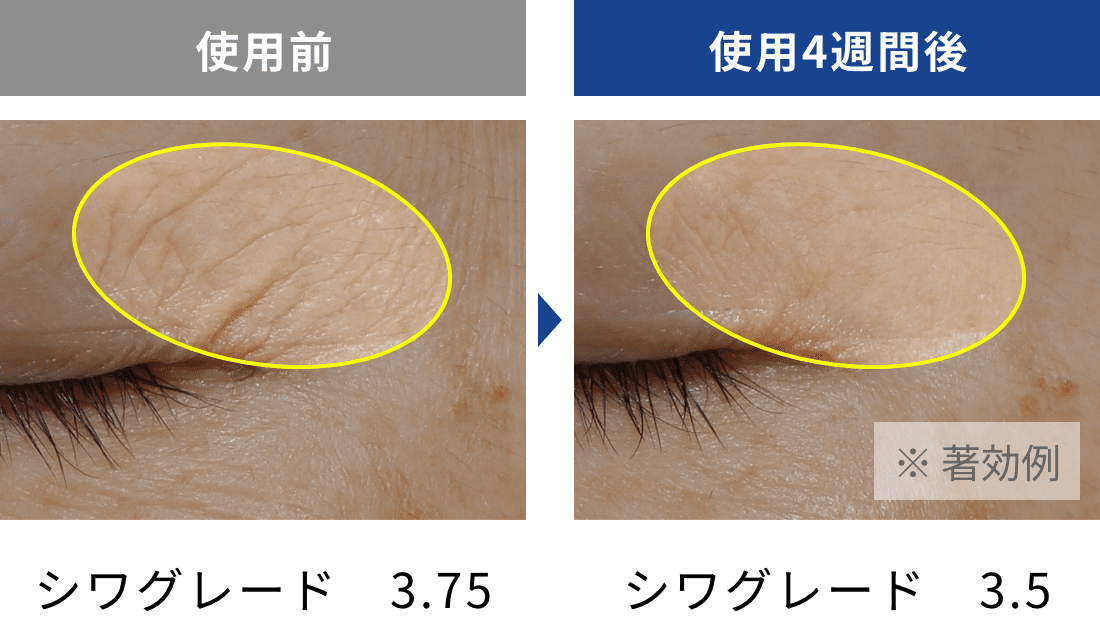 目もと、首もと