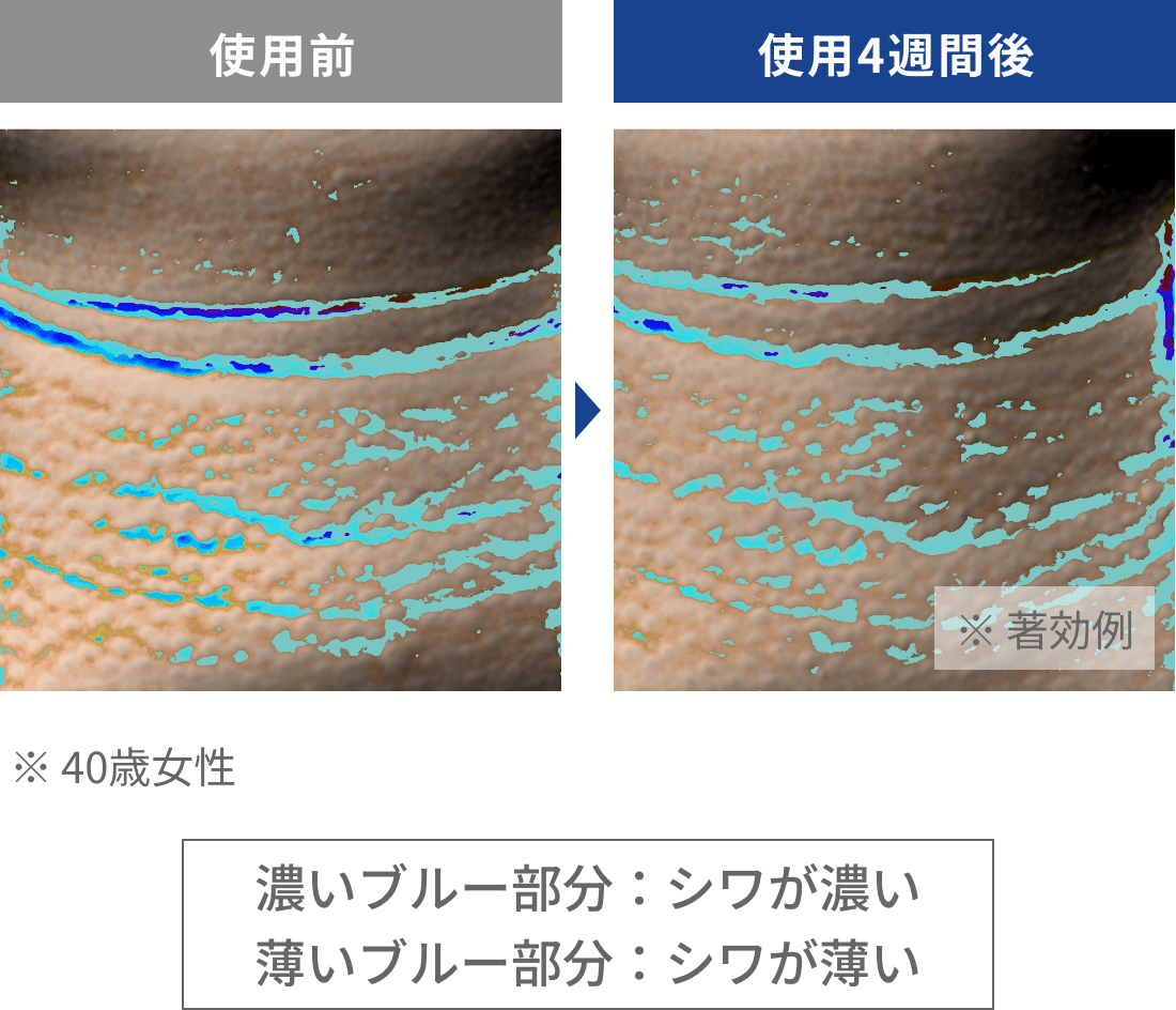 目もと、首もと