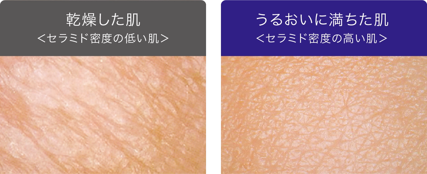 乾燥した肌＜セラミド密度の低い肌＞ うるおいに満ちた肌＜セラミド密度の高い肌＞