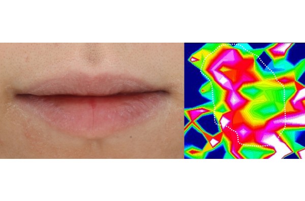 唇のあれやすさは細胞間脂質の密度の低さにあることを発見
唇あれを改善するリポソーム製剤を開発
<span class="filesize__info">PDF:622KB</span>