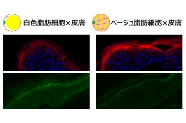 エネルギーを燃やす「ベージュ脂肪細胞」が肌のバリア機能を高めることを発見<span class="filesize__info">PDF:405KB</span>